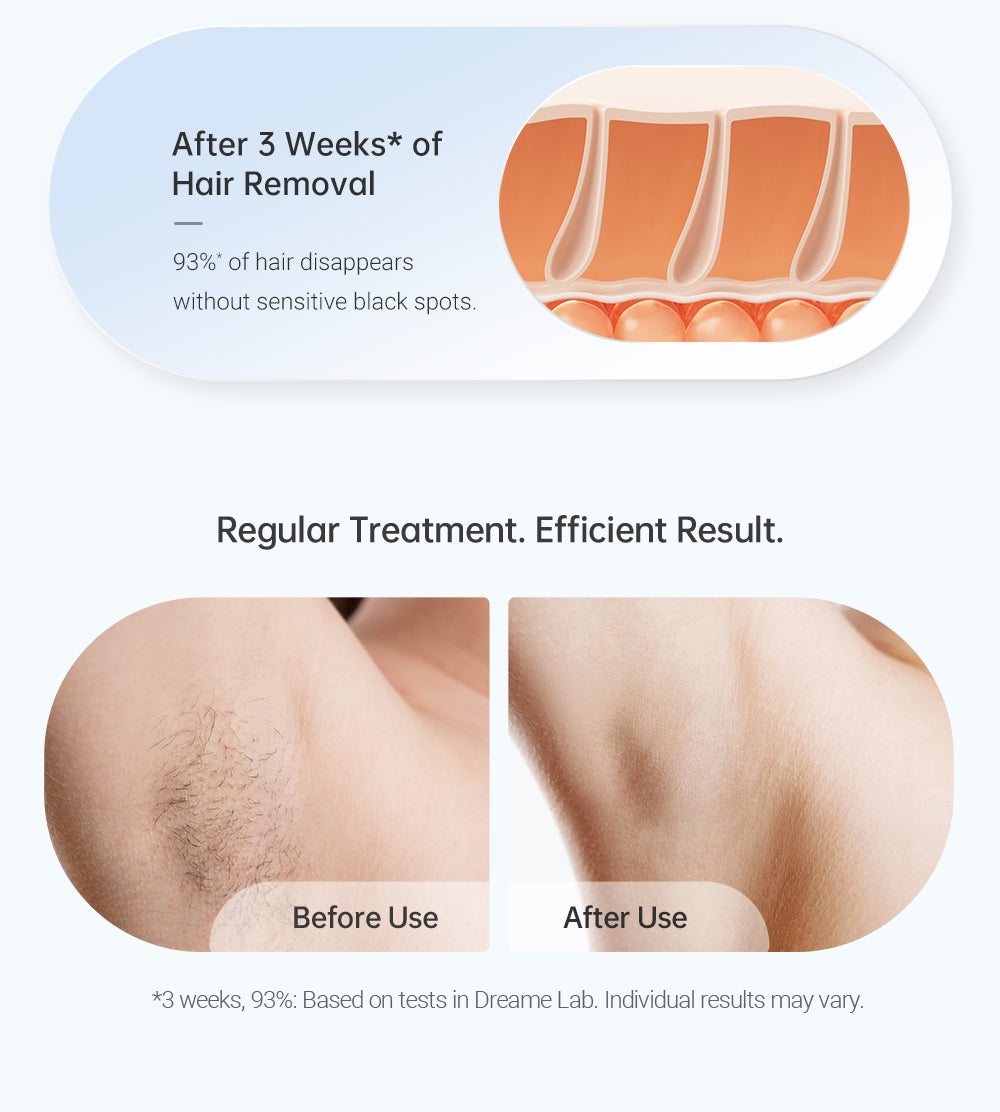 Dreame Hair Removal